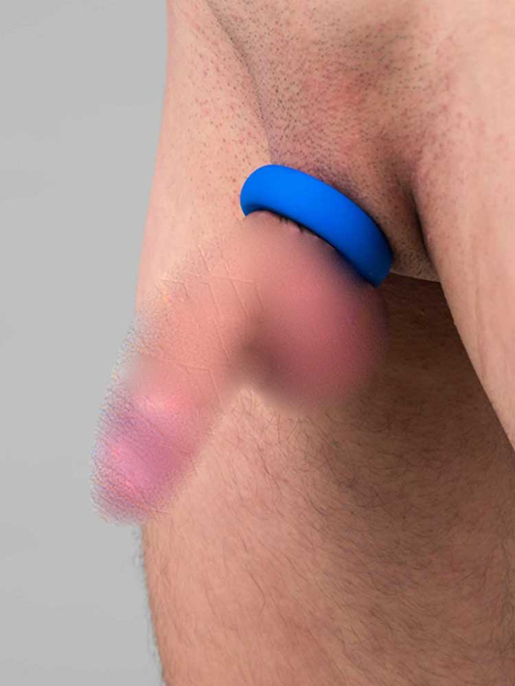 SPORTFUCKER Muscle-Ring Cockring Blau