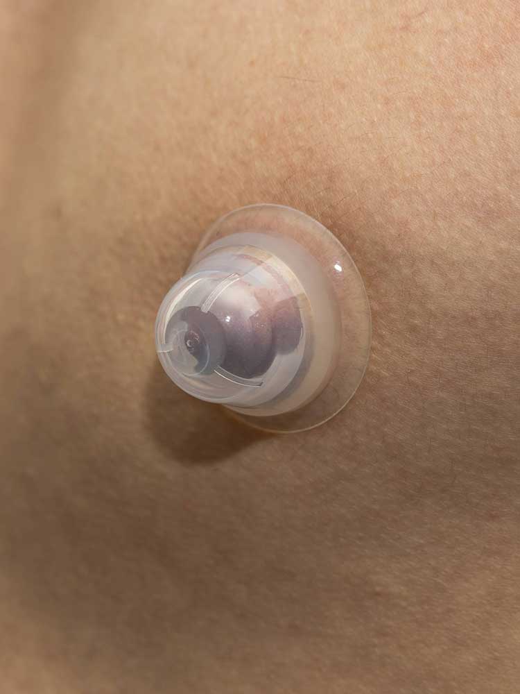 665 Super Silikon Nippel Sucker transparent in Reisebox