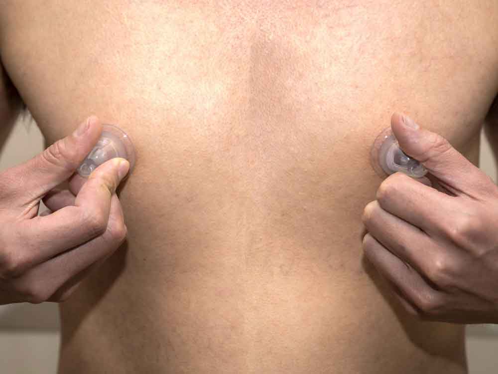 665 Super Silikon Nippel Sucker transparent in Reisebox